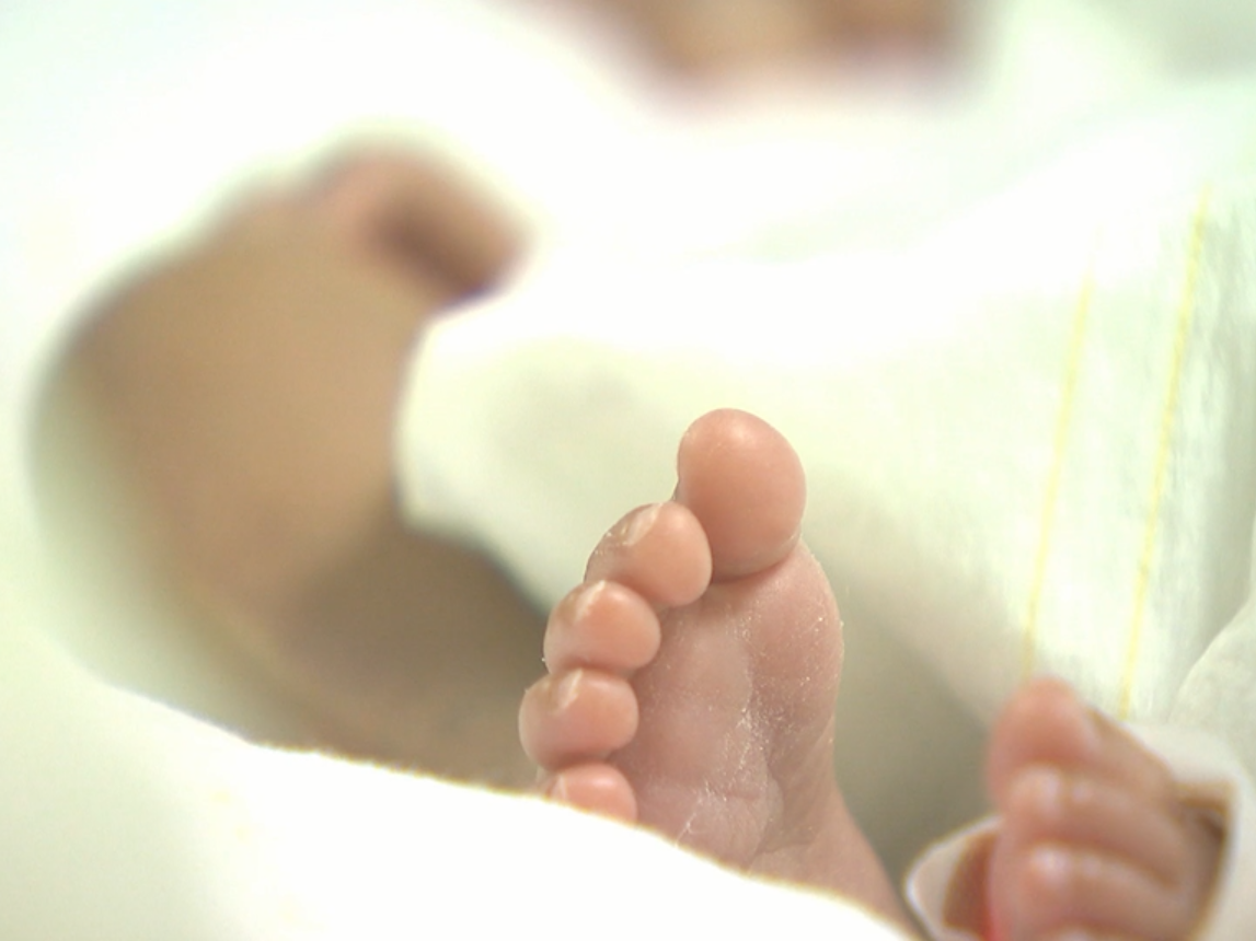 出生仅一天就用“人工肺”，江苏最小新生儿ECMO治疗患者出院了
