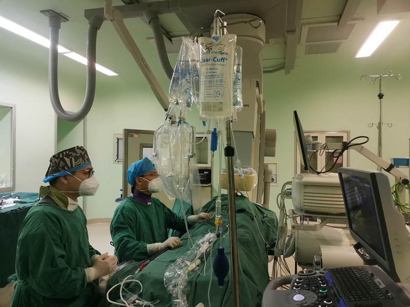 Carto V7 Prime心臟三維標測係統指導下的房顫射頻消融術在海南實施